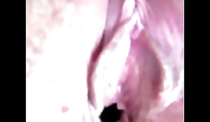 Vagina hermosa